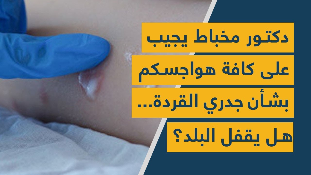 دكتور مخباط يجيب على كافة هواجسكم بشأن جدري القردة.. هل يقفل البلد؟